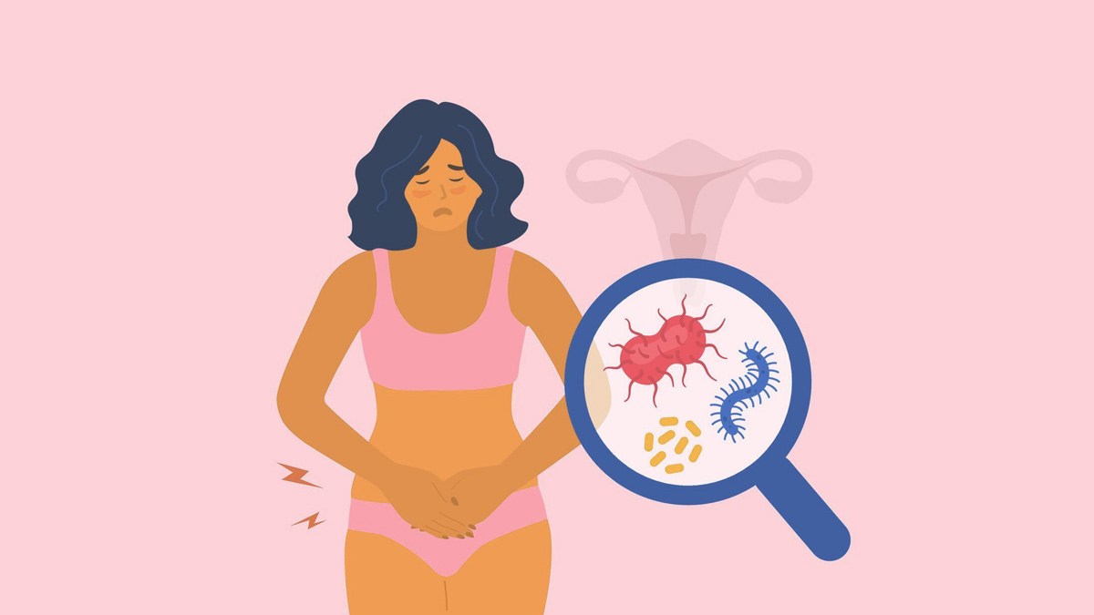 آموزش پیشگیری از عفونت های جنسی زنان + راهنمای کامل - لیدی کرمگ