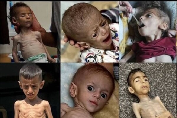 غزه زیر آتش و گرسنگی؛ صفهای غذا به قربانگاه تبدیل میشوند