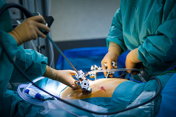 چاقی از کودکی آغاز میشود؛ تهدیدی جدی برای سلامت کشور