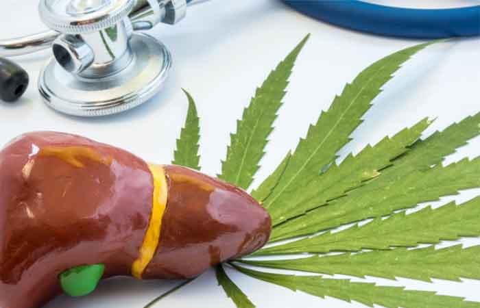 درمان کبد چرب با طب سنتی | طب سنتی دکتر سریتا